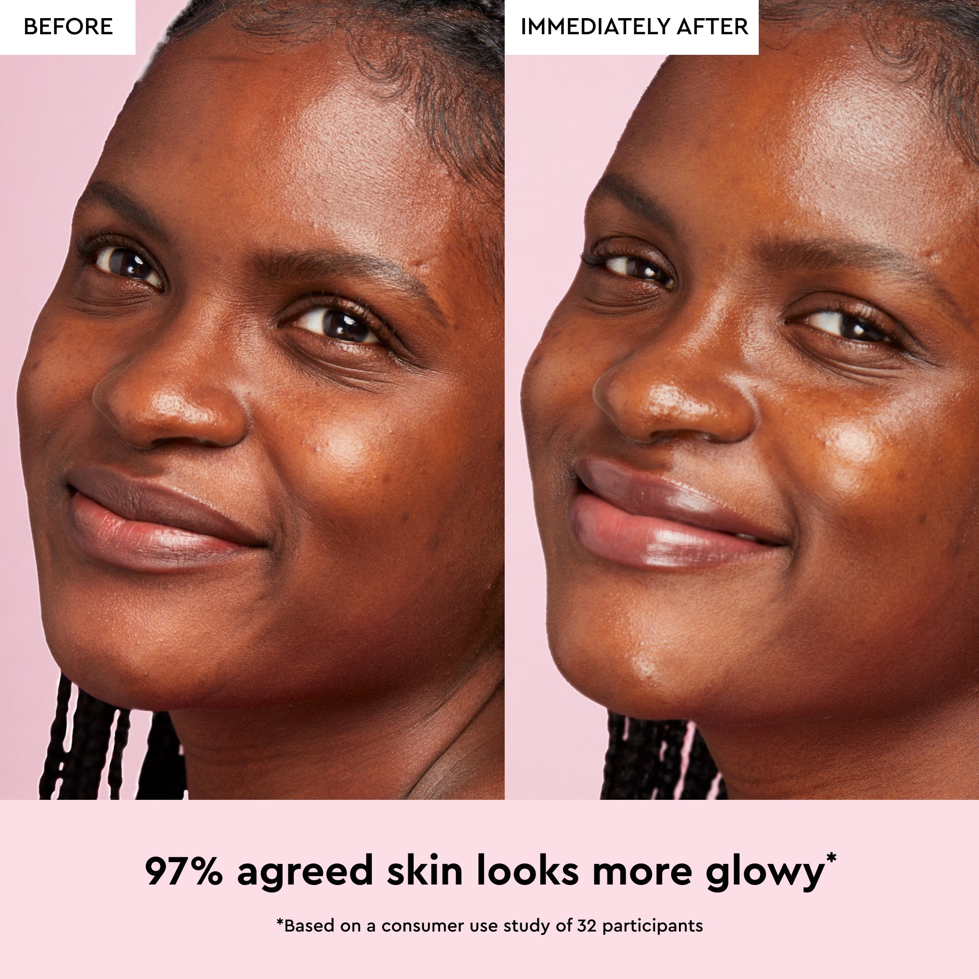 Glow Recipe Watermelon Glow Niacinamide Dew Drops infographic noting it suits oily and acne-prone skin types.