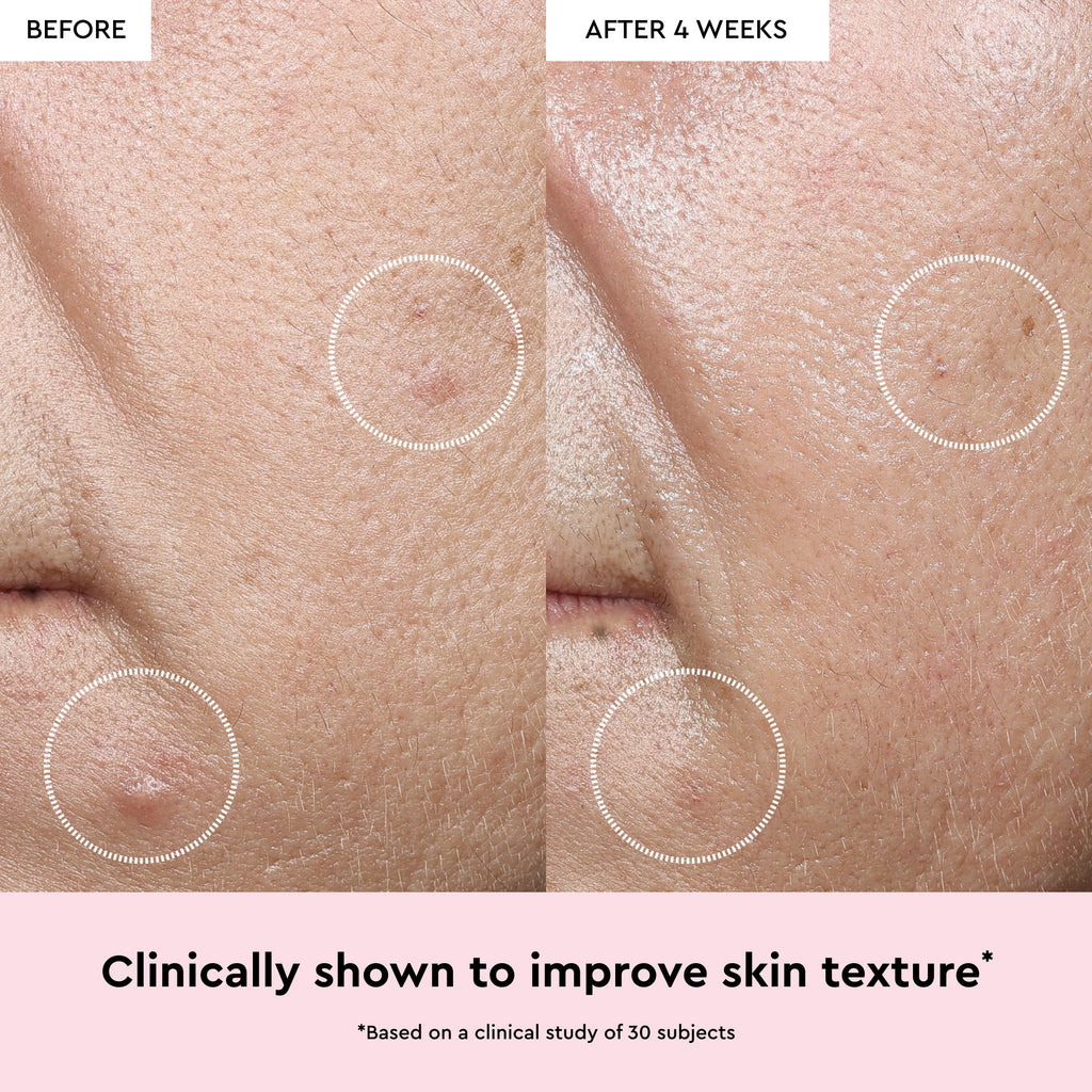 Glow Recipe Watermelon Glow Niacinamide Dew Drops infographic explaining how niacinamide visibly brightens skin.