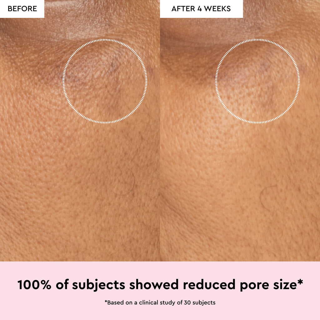 Glow Recipe Watermelon Glow Niacinamide Dew Drops infographic noting the formula contains no mica, glitter, or pearls.
