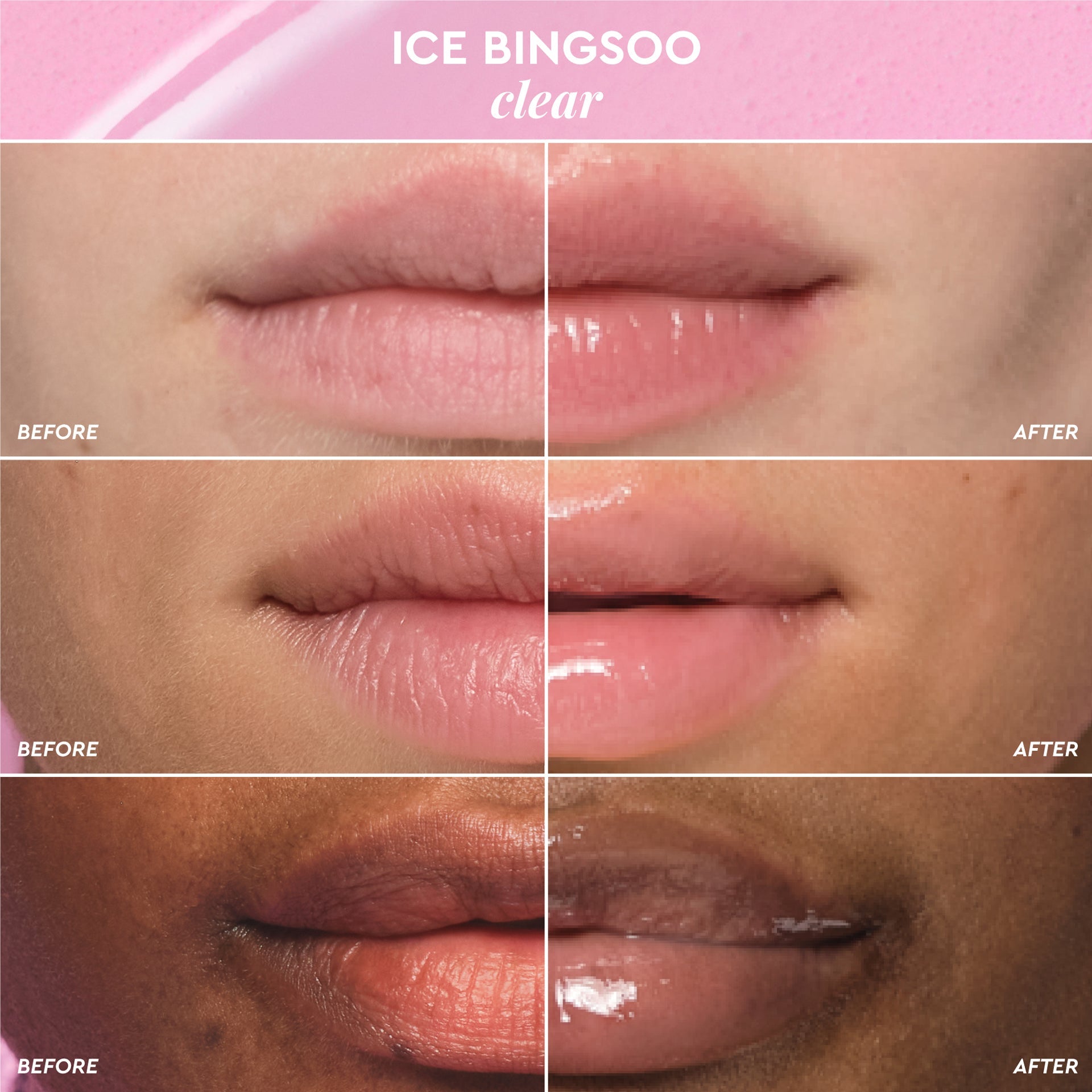 Before-and-after comparison graphic for lips wearing Glass Balm in Ice Bingsoo, the clear shade.
