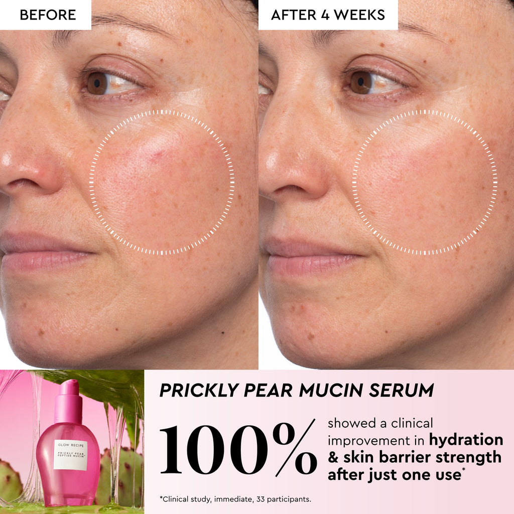 Infographic showcasing the Mini Watermelon Glow Niacinamide Dew Drops for brightening the look of dark spots.