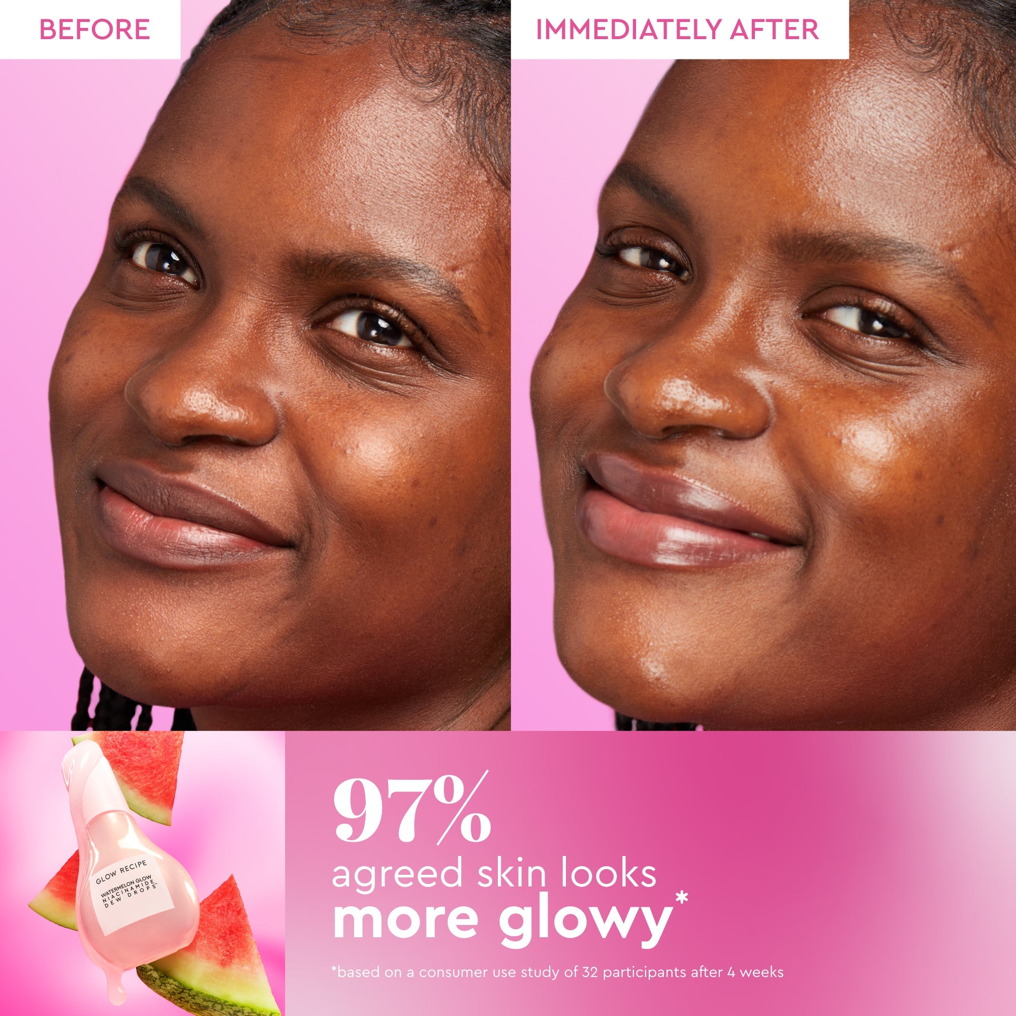 Glow Recipe Best of Dew & Hues Kit before-and-after slide for the Watermelon Glow Niacinamide Dew Drops serum