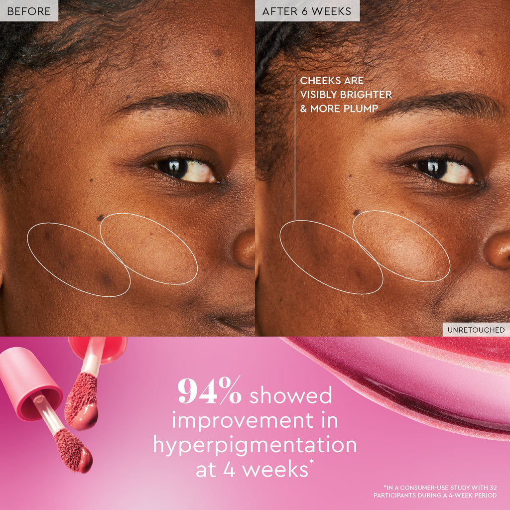 Glow Recipe Best of Glow Hues Kit before-and-after claim graphic showing the sheer flush from Dewy Flush Berry.