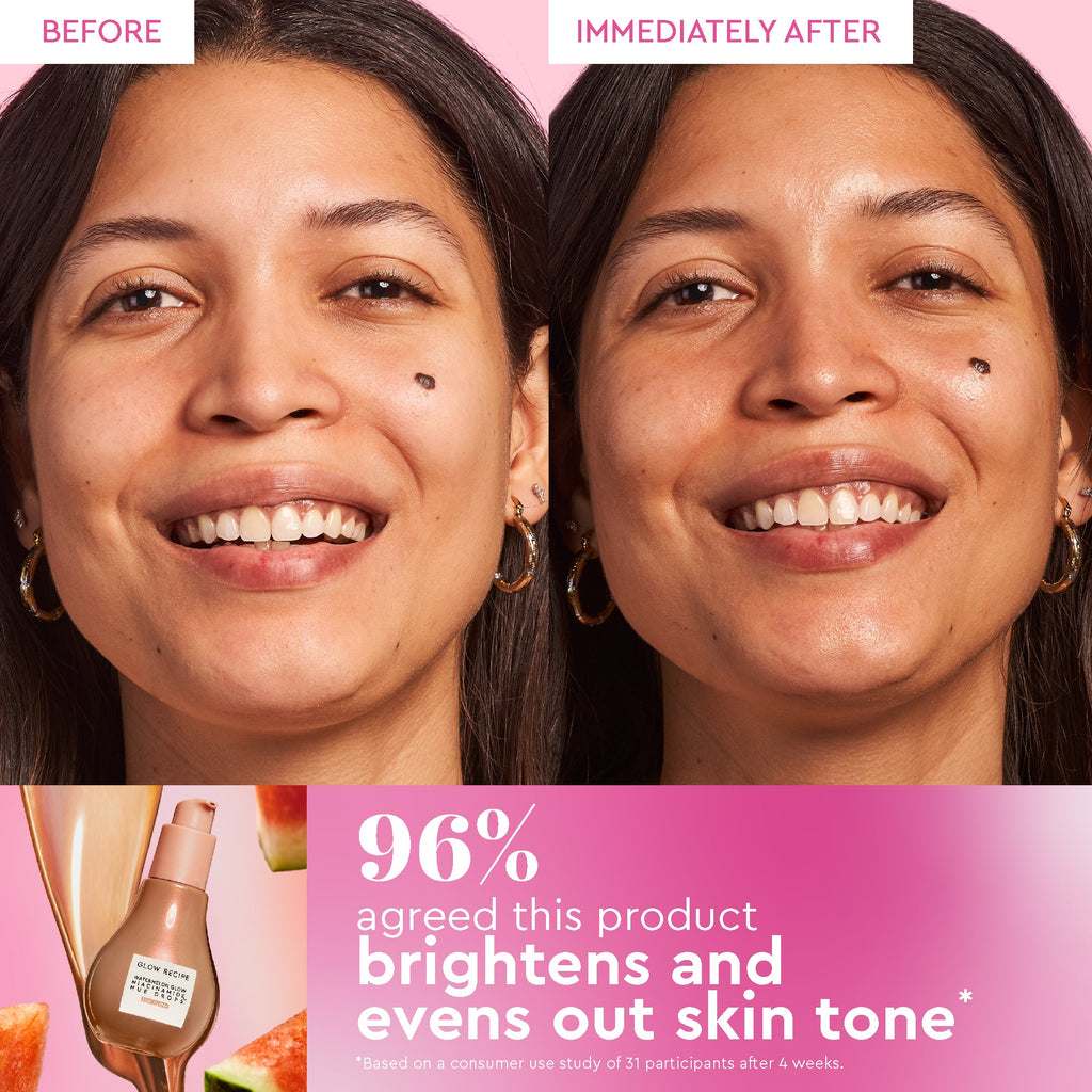 Glow Recipe Best of Glow Hues Kit before-and-after showing the warm, all-over glow from Hue Drops Sun Glow serum.