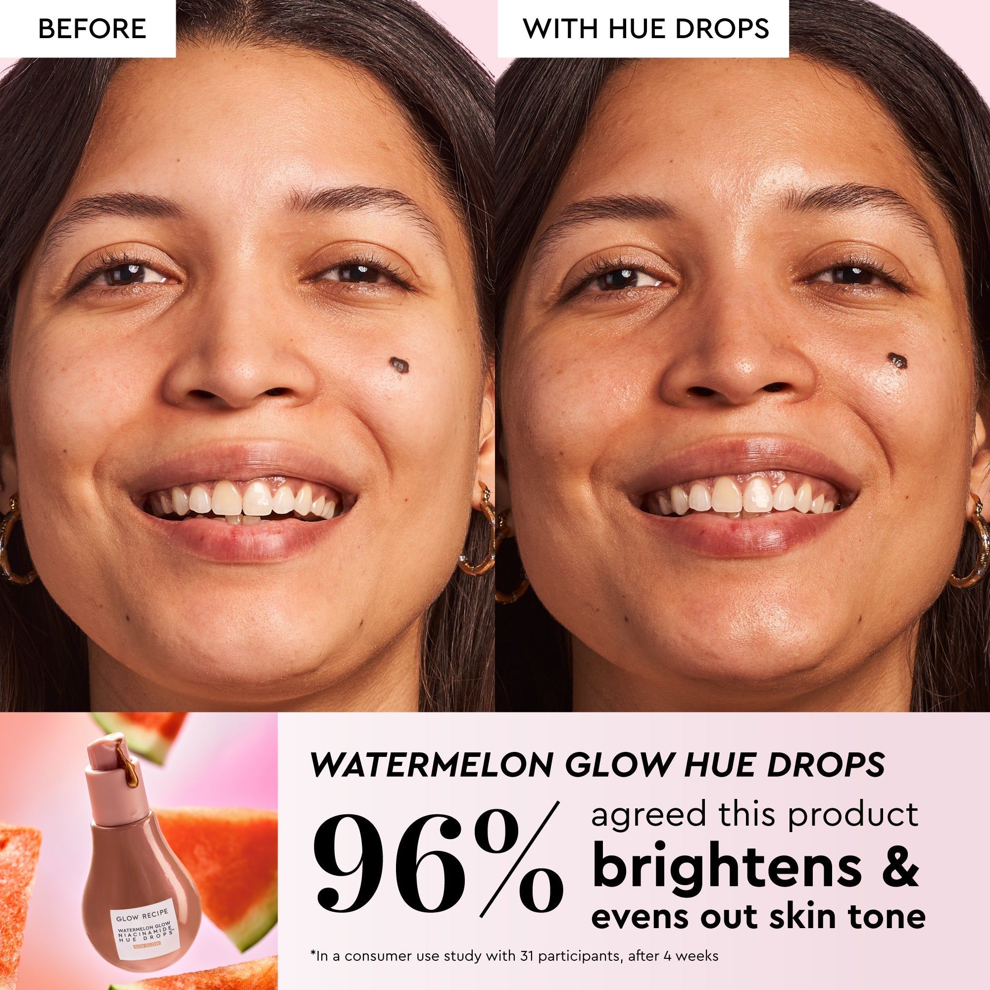 Infographic slide highlighting the Mini Watermelon Glow Niacinamide Dew Drops for fading dark spots.