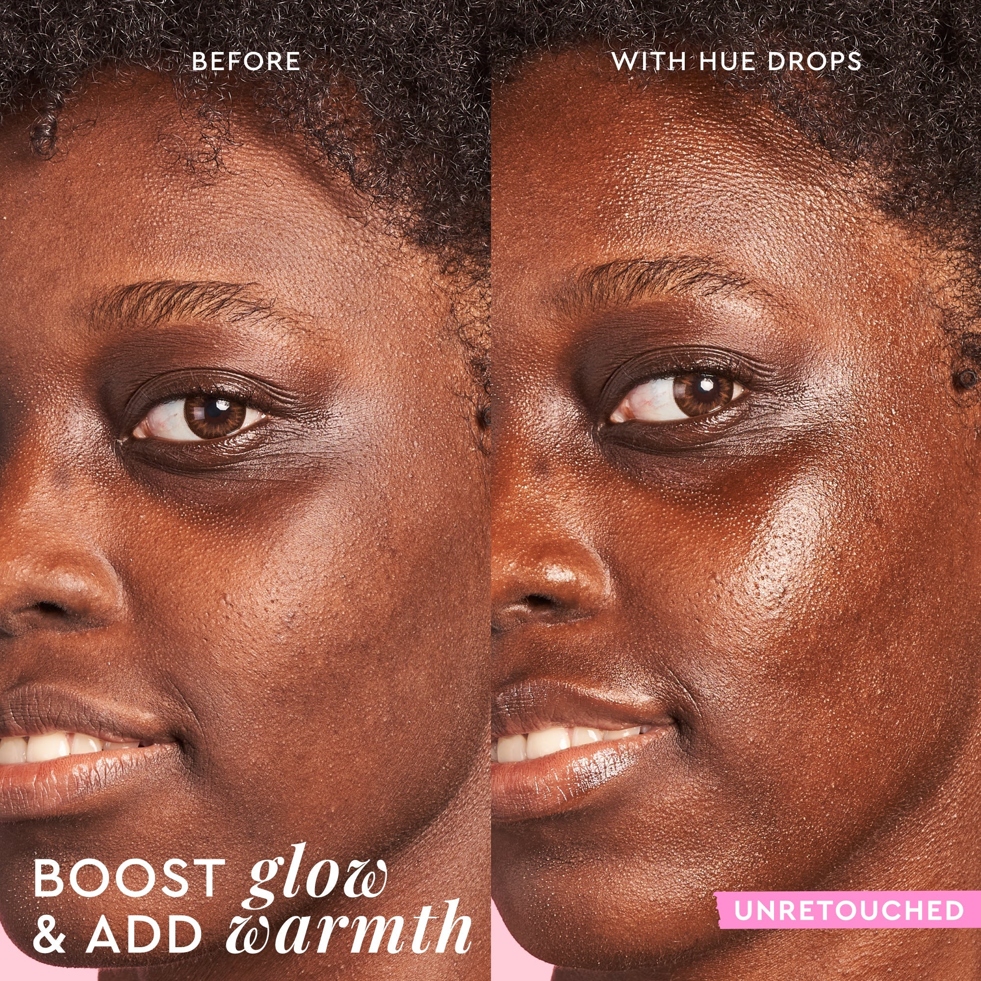 Before-and-after result of Watermelon Glow Niacinamide Hue Drops, illustrating its brightening, non-streaky finish.