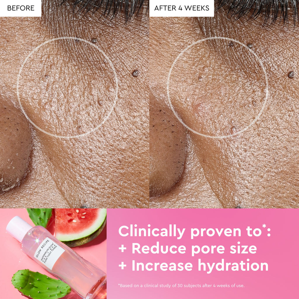Before and after comparison of skin texture with a skincare product bottle and watermelon slices in the background.