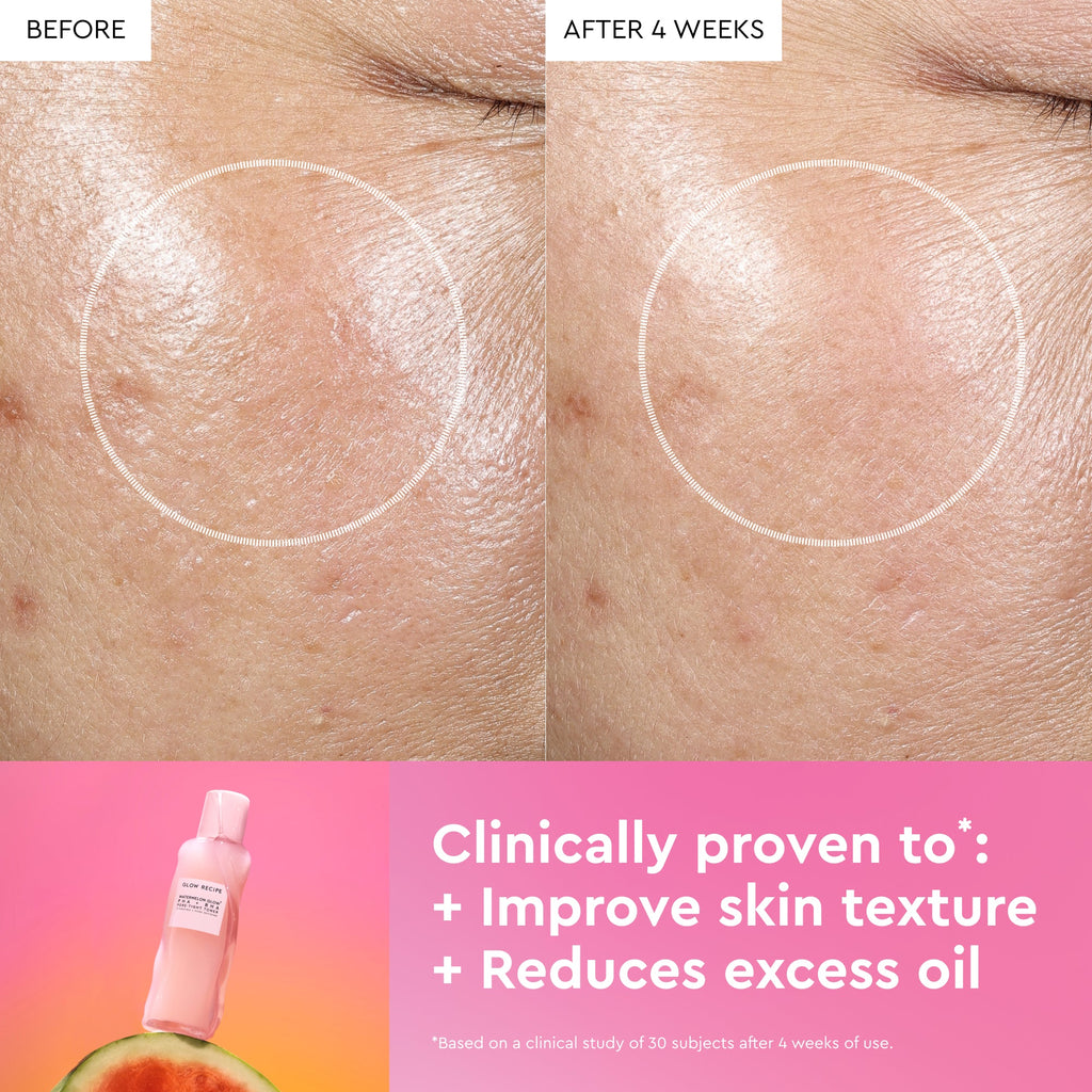 Before and after comparison of skin texture improvement with a skincare product, showing a bottle and watermelon slice.