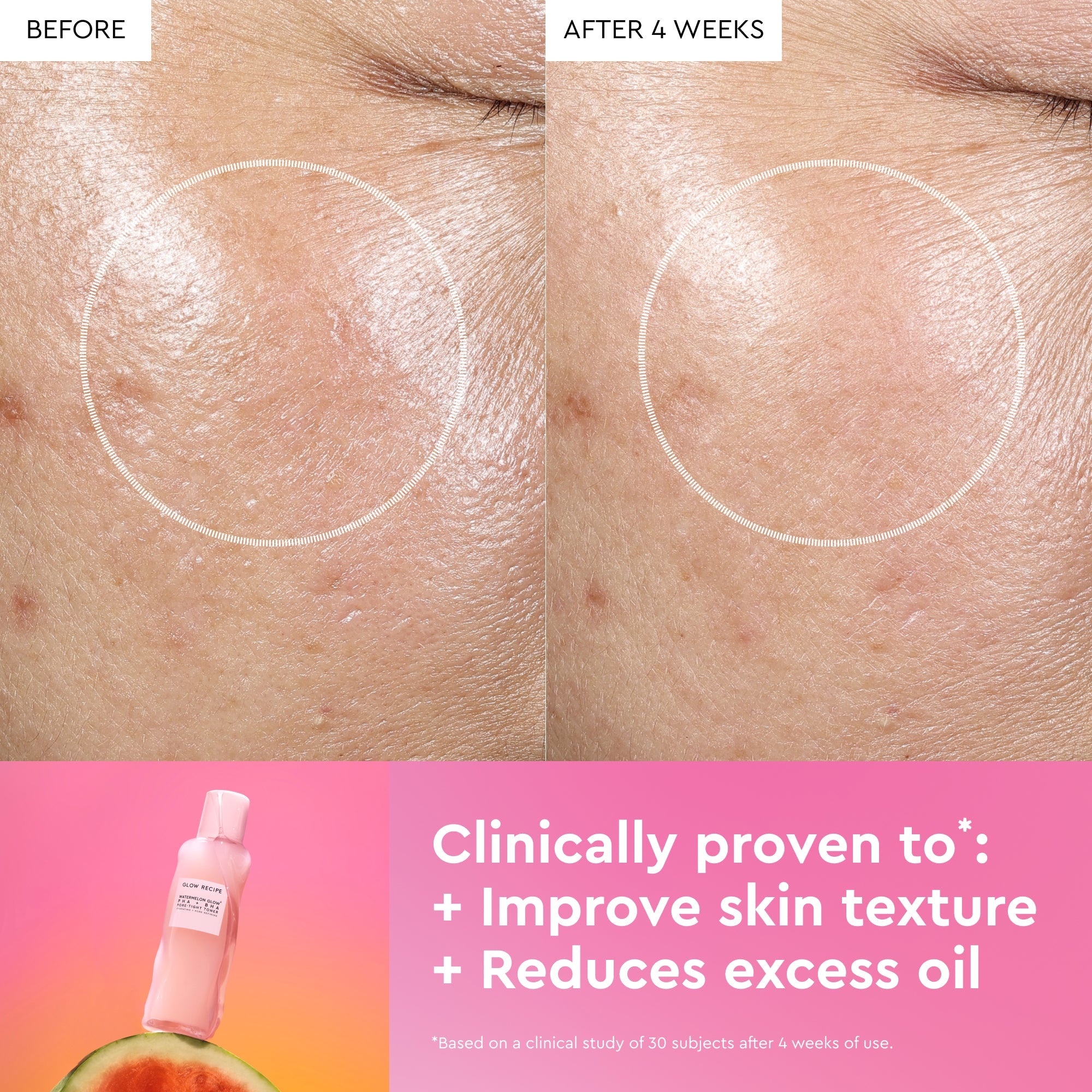 Before and after comparison of skin texture improvement with a skincare product, showing a bottle and watermelon slice.