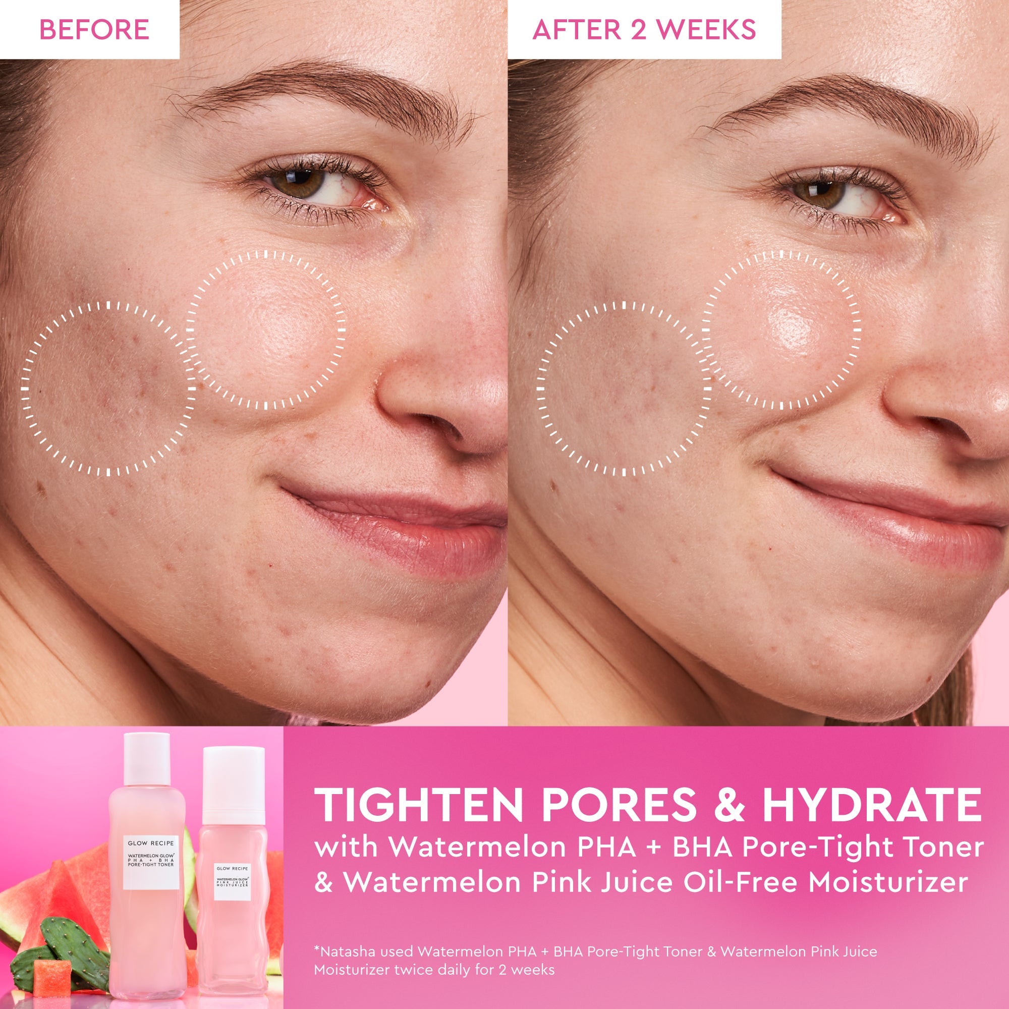 Before-and-after comparison of pore size and skin clarity displayed alongside the Watermelon Glow PHA+BHA Toner bottle.