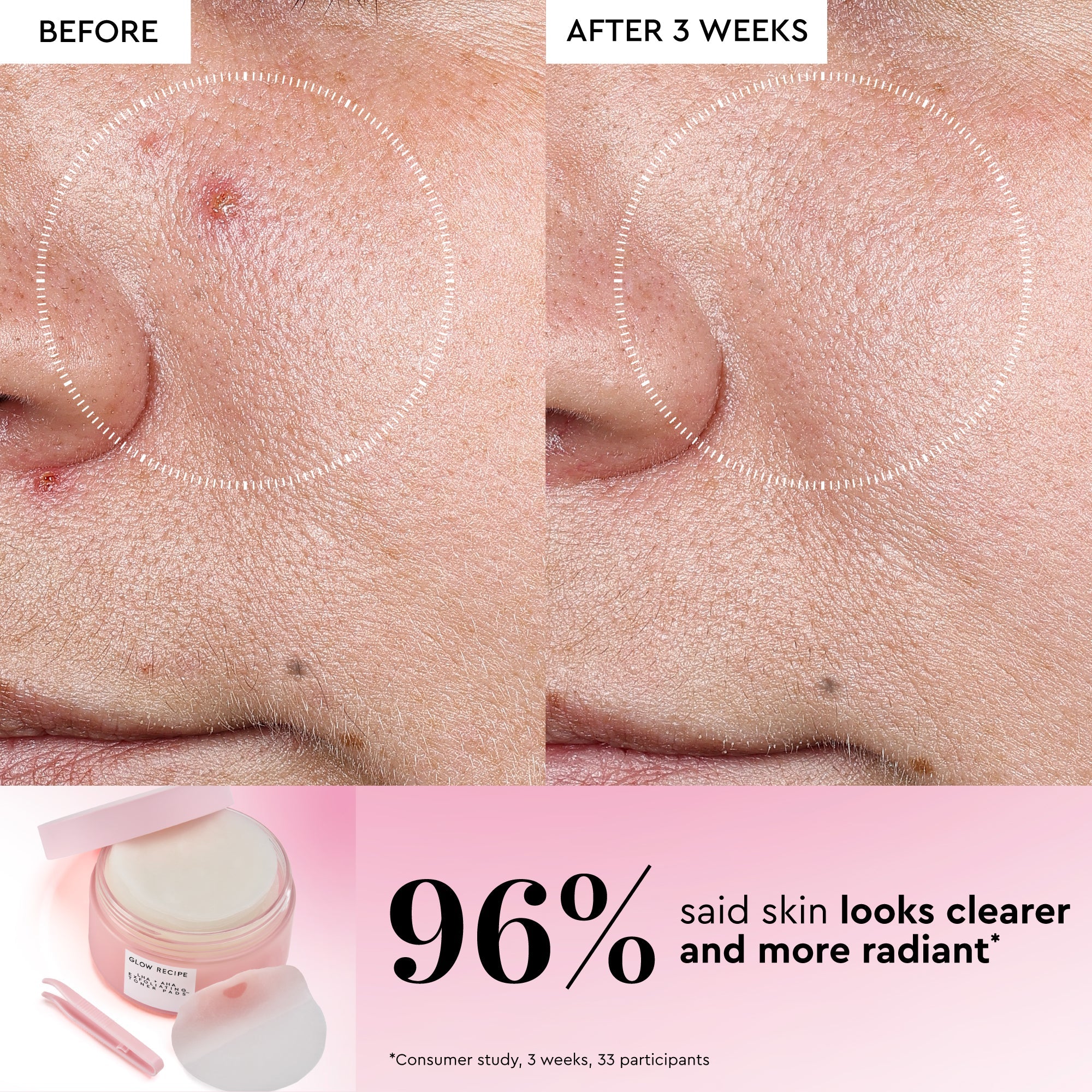 Glow Recipe LHA + AHA Korean Toner Pads infographic detailing how the fragrance-free formula soothes and hydrates skin.