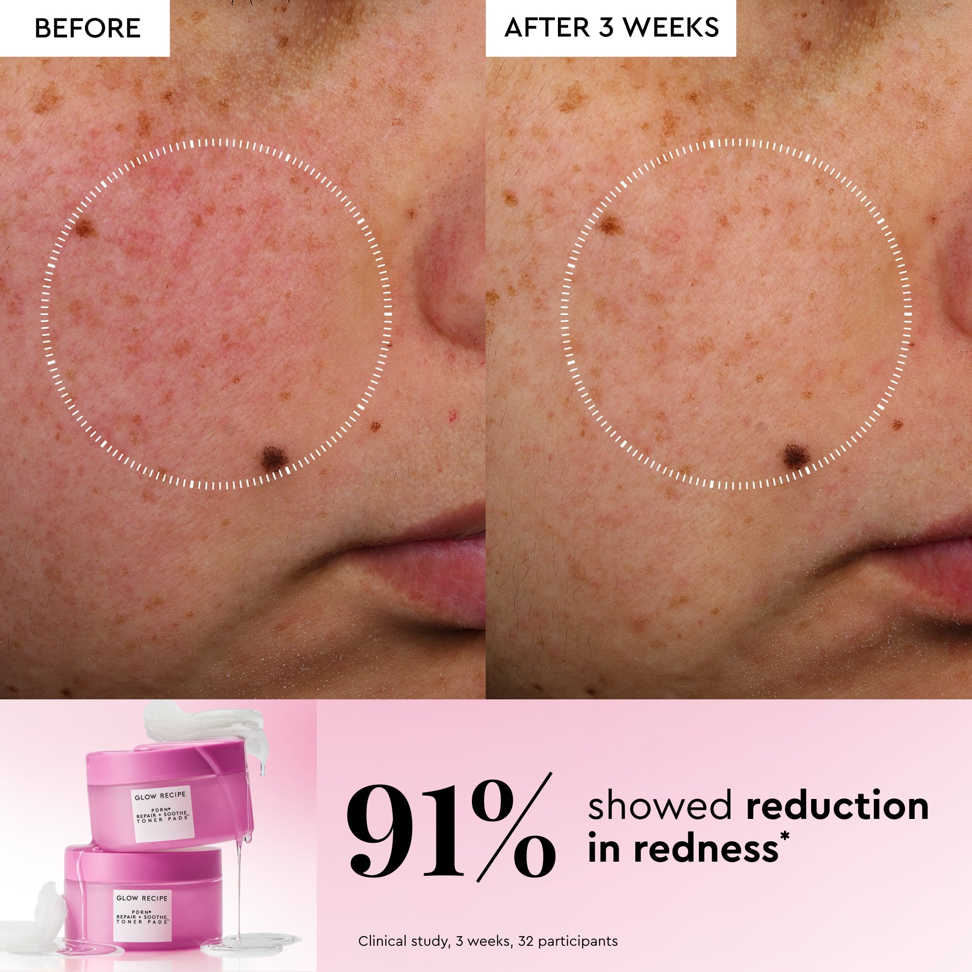 Infographic introducing Glow Recipe's PDRN+ Toner Pads and their 5-minute Korean facial-in-a-pad routine.