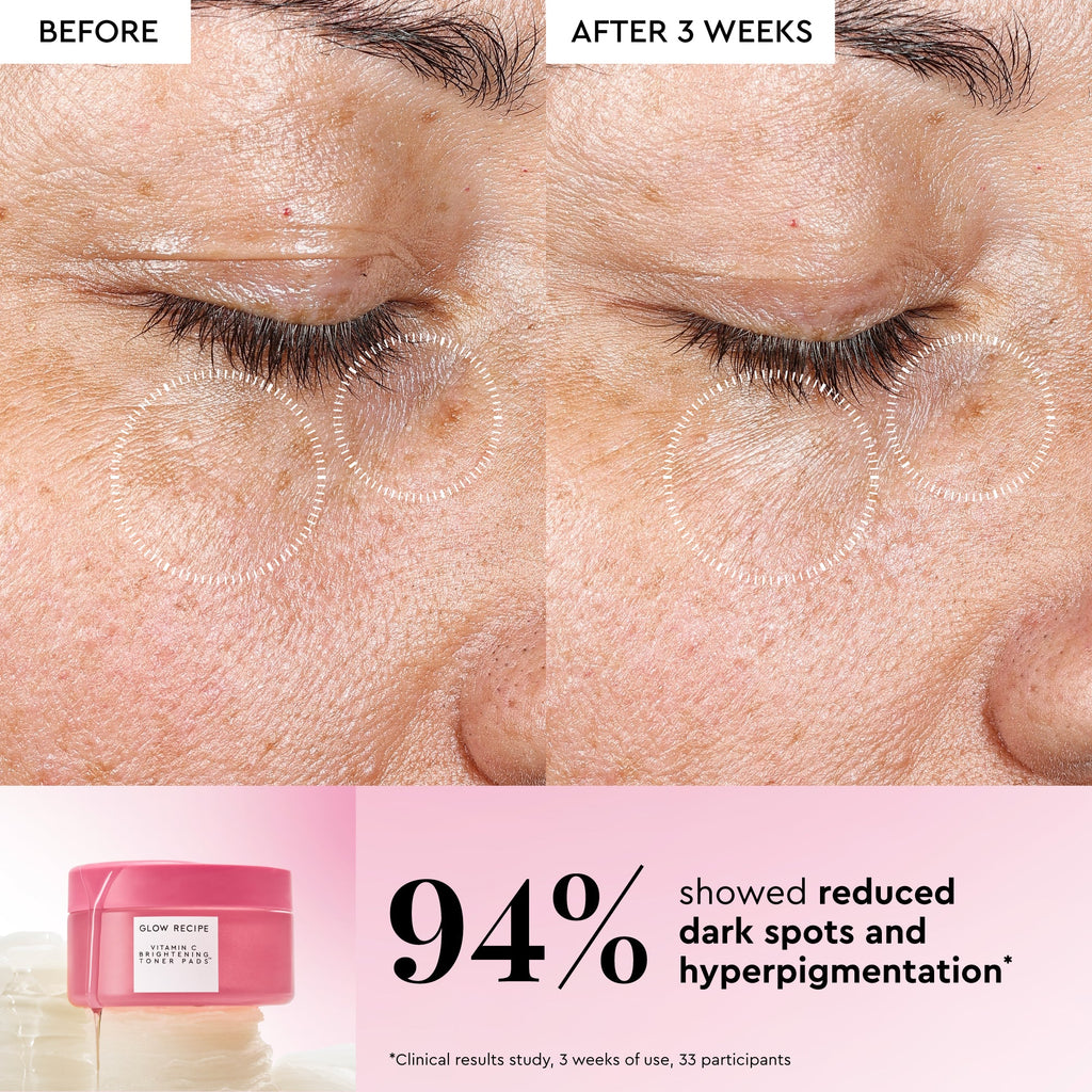 Glow Recipe Vitamin C Toner Pad infographic detailing brightening ingredients and the 5-minute sachet treatment