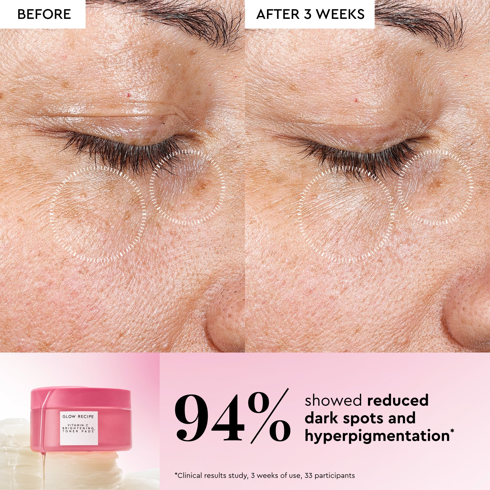 Infographic slide introducing the pads' 5 types of Vitamin C formulated to visibly fade dark spots and brighten dull skin.